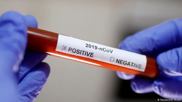 Zimbabwe Coronavirus/COVID-19 Update – 30/11/2020