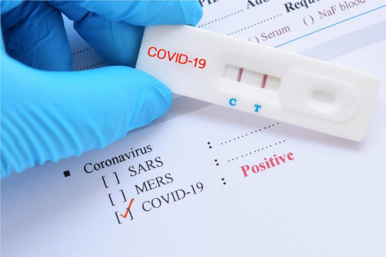 Bulawayo Records Increase In Active Covid-19 Cases