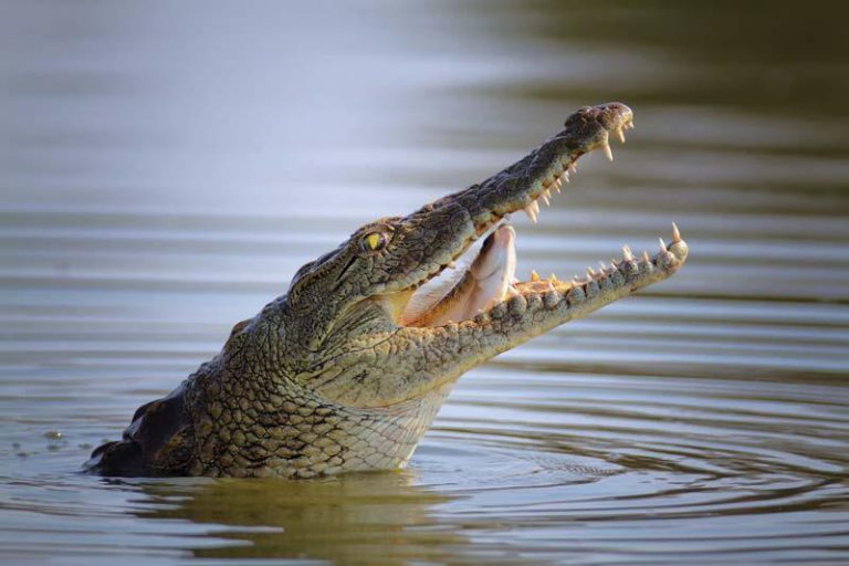 Crocodile Attack Survivor “Detained” By Zambian Hospital Over Unpaid Bill