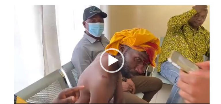 JUST IN: Many Injured As ZANU PF Clash With CCC Supporters