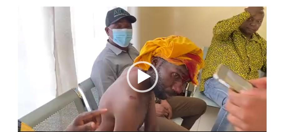 JUST IN: Many Injured As ZANU PF Clash With CCC Supporters JUST IN: Many Injured As ZANU PF Clash With CCC Supporters