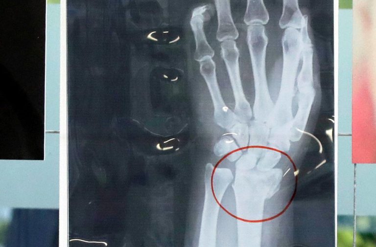 Govt Repairs X-ray Machine Which Broke Down Four Years Ago