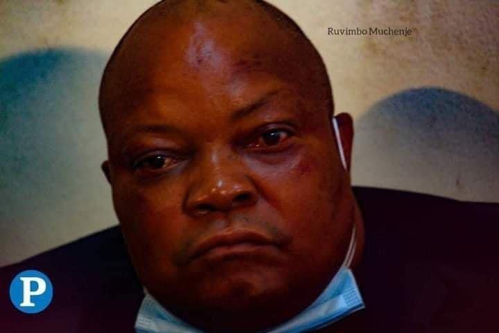 Job Sikhala Unwell, Fails To Attend Court
