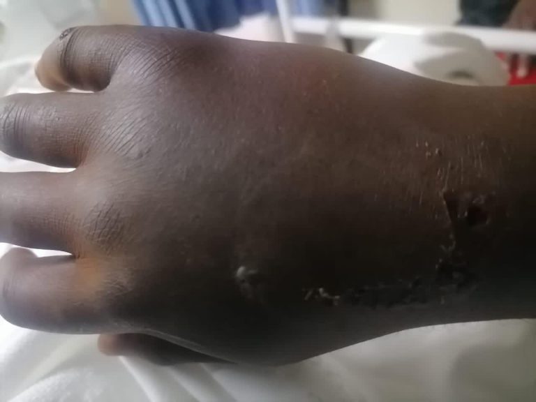 Human rights lawyer Shava battling for life